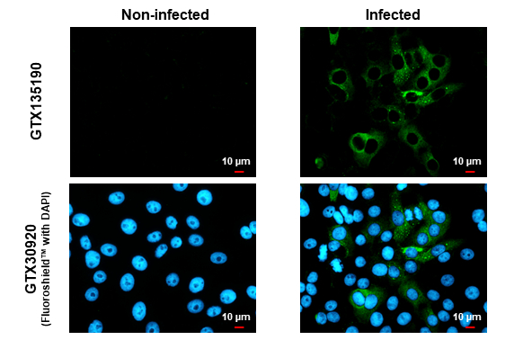 Anti-Chikungunya virus nsP4 antibody (GTX135190) | GeneTex